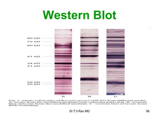 Western Blot
98
Dr.T.V.Rao MD
 
