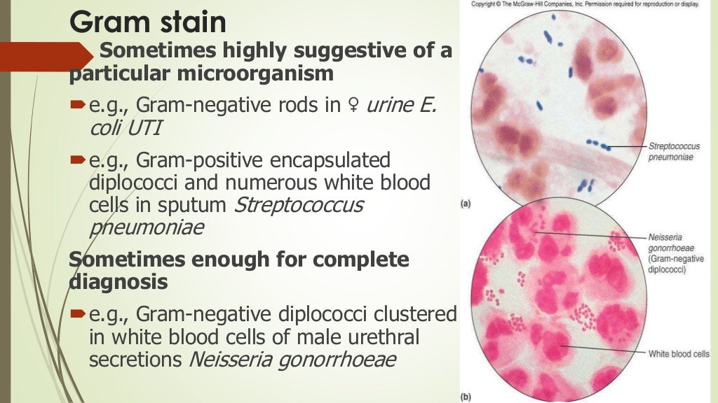 Bacterial identification