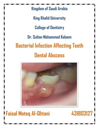 1
Kingdom of Saudi Arabia
King Khalid University
College of Dentistry
Dr. Sultan Mohammed Kaleem
Bacterial Infection Affecting Teeth
Dental Abscess
Faisal Moteq Al-Qhtani 431803127
 