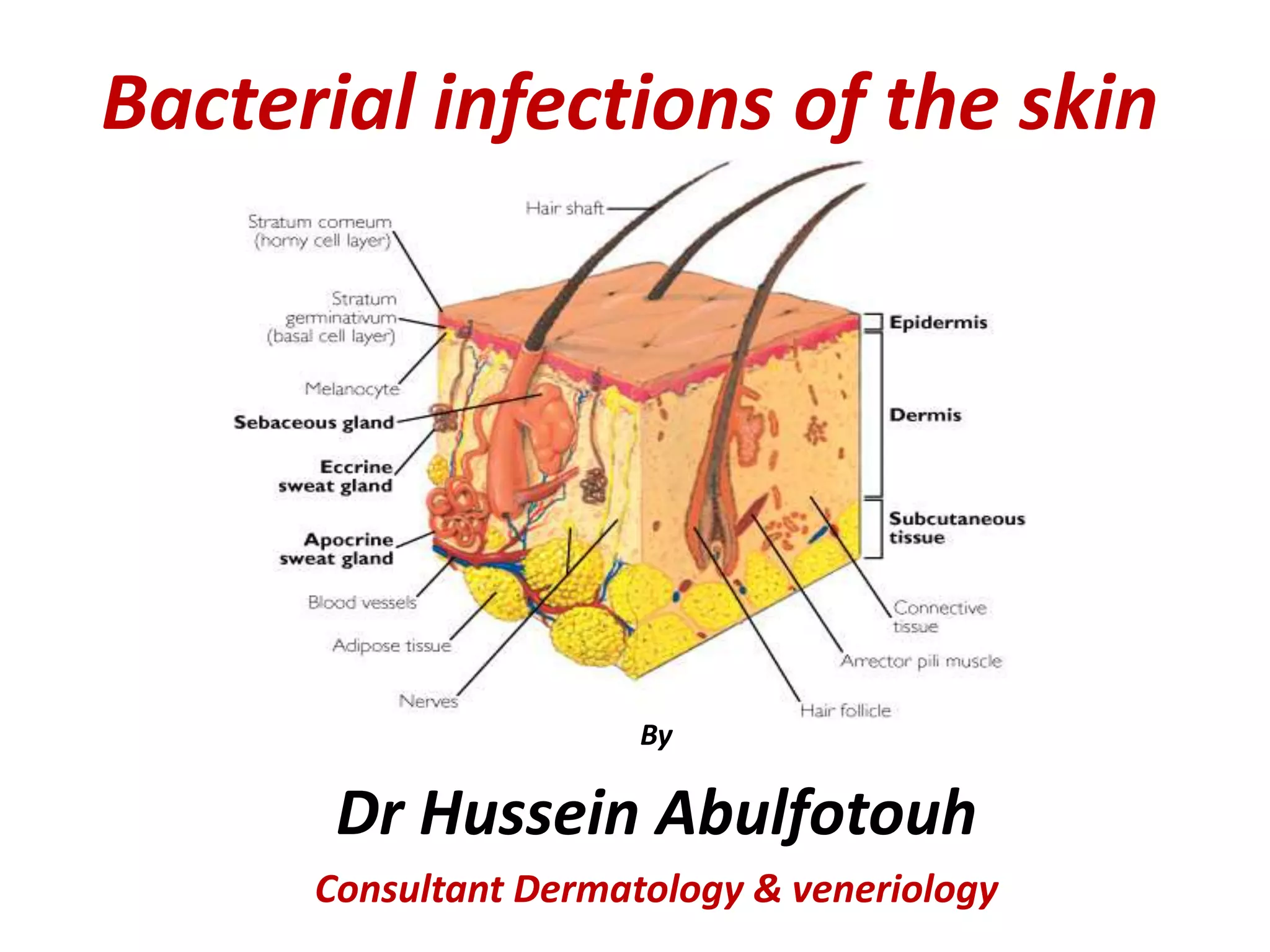 Bacterial infection of the skin | PPTX