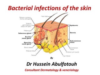 Bacterial infections of the skin

By

Dr Hussein Abulfotouh
Consultant Dermatology & veneriology

 