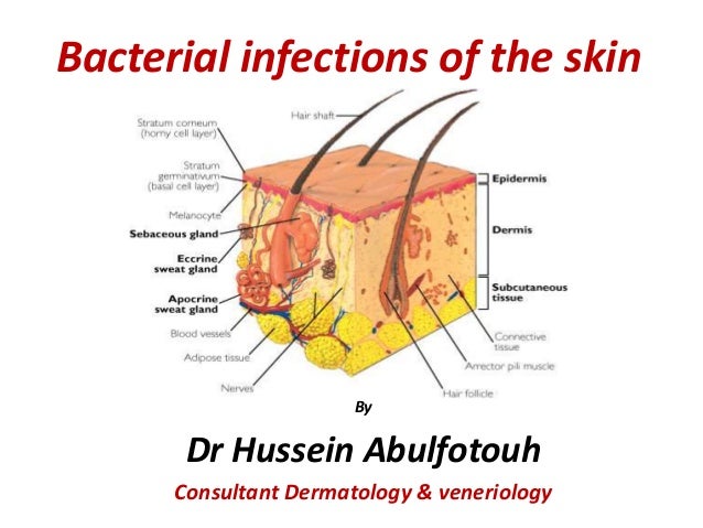 bacterial infection on skin #10