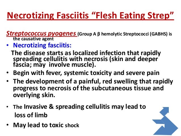streptococcus pyogenes necrotising fasciitis essay Bromine, bear-claw scratch fasciotomies, and the eagle eff ect: management of group a streptococcal necrotising necrotising fasciitis is a rare. streptococcus pyogenes necrotising fasciitis essay Bromine, bear-claw scratch fasciotomies, and the eagle eff ect: management of group a streptococcal necrotising necrotising fasciitis is a rare.