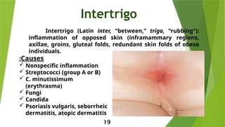 Invitigo Bacterial infection of the skin.pptx