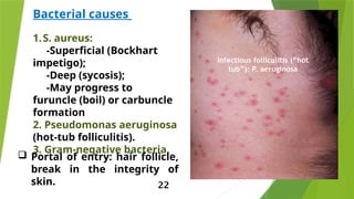 Bacterial infection of the skin.pptx