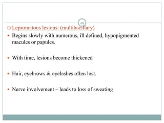  Lepromatous lesions: (multibacillary)
 Begins slowly with numerous, ill defined, hypopigmented
macules or papules.
 With time, lesions become thickened
 Hair, eyebrows & eyelashes often lost.
 Nerve involvement – leads to loss of sweating
49
 
