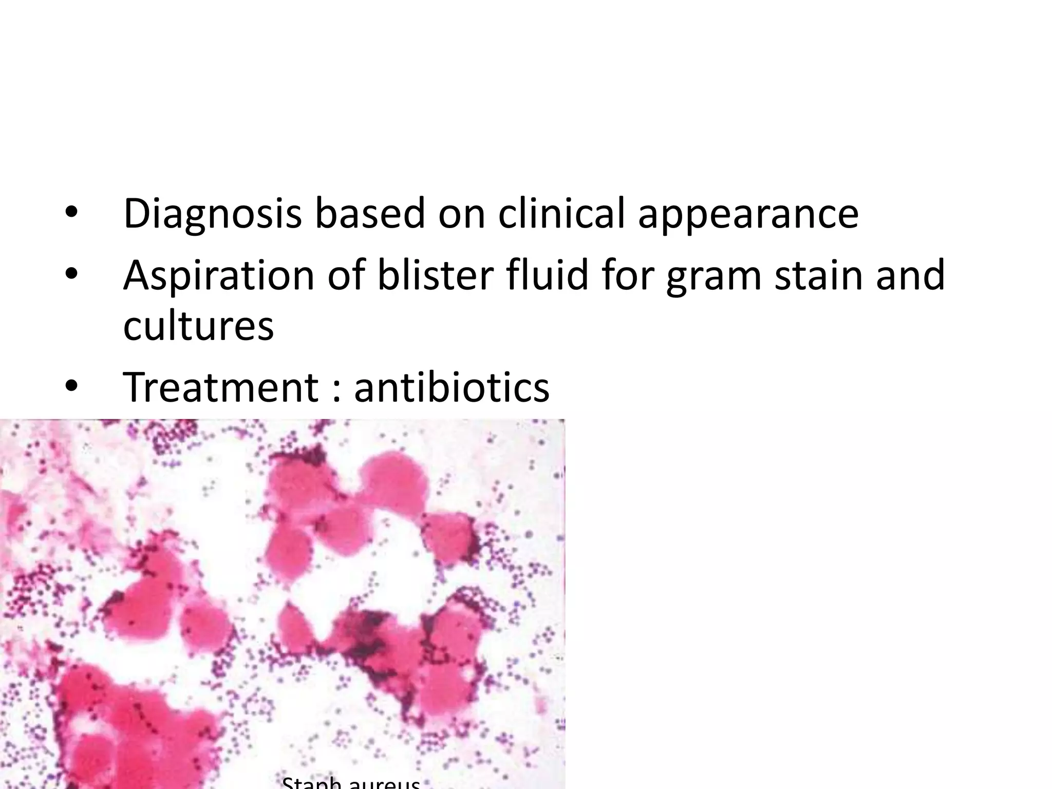 • Diagnosis based on clinical appearance
• Aspiration of blister fluid for gram stain and
cultures
• Treatment : antibiotics
 