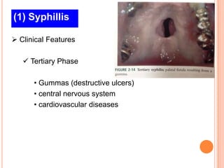(1) Syphillis

 Clinical Features

    Tertiary Phase

      • Gummas (destructive ulcers)
      • central nervous system
      • cardiovascular diseases
 