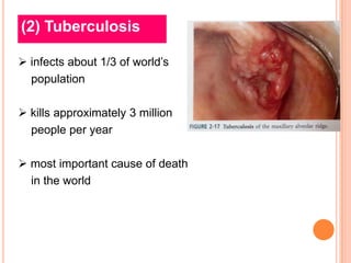 (2) Tuberculosis

 infects about 1/3 of world’s
  population

 kills approximately 3 million
  people per year

 most important cause of death
  in the world
 