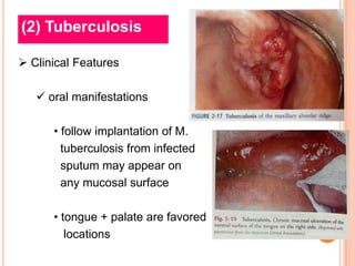 (2) Tuberculosis

 Clinical Features

    oral manifestations

      • follow implantation of M.
        tuberculosis from infected
        sputum may appear on
        any mucosal surface

      • tongue + palate are favored
         locations
 
