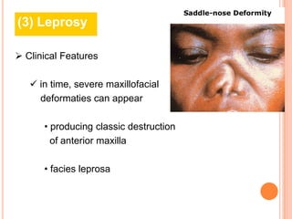 (3) Leprosy

 Clinical Features

    in time, severe maxillofacial
     deformaties can appear

      • producing classic destruction
        of anterior maxilla

      • facies leprosa
 