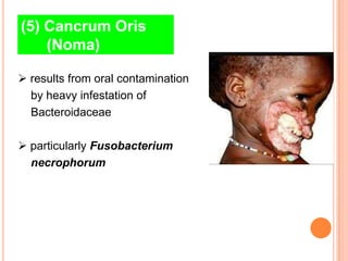 (5) Cancrum Oris
    (Noma)

 results from oral contamination
  by heavy infestation of
  Bacteroidaceae

 particularly Fusobacterium
  necrophorum
 
