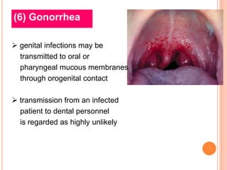 (6) Gonorrhea

 genital infections may be
  transmitted to oral or
  pharyngeal mucous membranes
  through orogenital contact

 transmission from an infected
  patient to dental personnel
  is regarded as highly unlikely
 