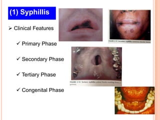 (1) Syphillis

 Clinical Features

    Primary Phase

    Secondary Phase

    Tertiary Phase

    Congenital Phase
 