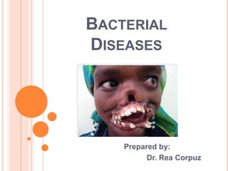 BACTERIAL
DISEASES




    Prepared by:
          Dr. Rea Corpuz
 