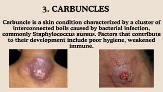 BACTERIAL INFECTIONS OF HUMANS.nsisiwiwiwiwispdf | PDF