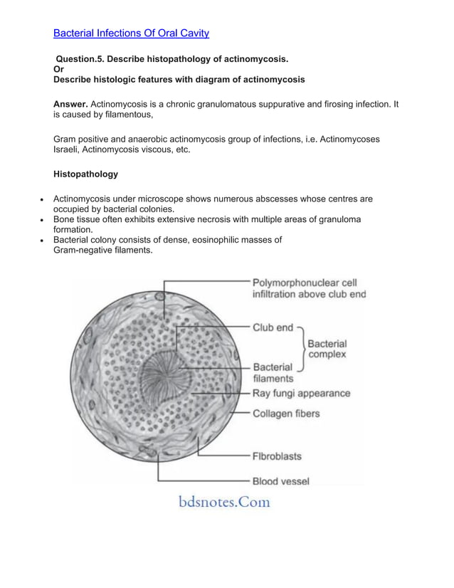 Bacterial Infections of the Oral Mucosa | PDF