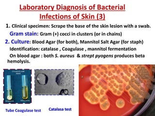 Laboratory Diagnosis of Bacterial
Infections of Skin (3)
1. Clinical specimen: Scrape the base of the skin lesion with a swab.
Gram stain: Gram (+) cocci in clusters (or in chains)
2. Culture: Blood Agar (for both), Mannitol Salt Agar (for staph)
Identification: catalase , Coagulase , mannitol fermentation
On blood agar : both S. aureus & strept pyogens produces beta
hemolysis.
Catalasa testTube Coagulase test
 