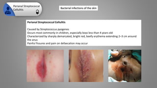 Bacterial infections of the skin.pptx