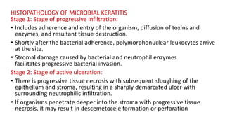 HISTOPATHOLOGY OF MICROBIAL KERATITIS
Stage 1: Stage of progressive infiltration:
• Includes adherence and entry of the organism, diffusion of toxins and
enzymes, and resultant tissue destruction.
• Shortly after the bacterial adherence, polymorphonuclear leukocytes arrive
at the site.
• Stromal damage caused by bacterial and neutrophil enzymes
facilitates progressive bacterial invasion.
Stage 2: Stage of active ulceration:
• There is progressive tissue necrosis with subsequent sloughing of the
epithelium and stroma, resulting in a sharply demarcated ulcer with
surrounding neutrophilic infiltration.
• If organisms penetrate deeper into the stroma with progressive tissue
necrosis, it may result in descemetocele formation or perforation
 
