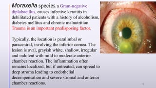 Moraxella species, a Gram-negative
diplobacillus, causes infective keratitis in
debilitated patients with a history of alcoholism,
diabetes mellitus and chronic malnutrition.
Trauma is an important predisposing factor.
Typically, the location is paralimbal or
paracentral, involving the inferior cornea. The
lesion is oval, grayish white, shallow, irregular
and indolent with mild to moderate anterior
chamber reaction. The inflammation often
remains localized, but if untreated, can spread to
deep stroma leading to endothelial
decompensation and severe stromal and anterior
chamber reactions. 15
 