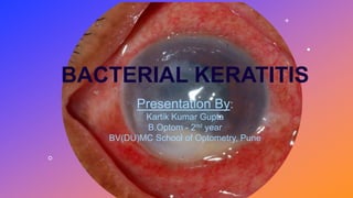 BACTERIAL KERATITIS
Presentation By:
Kartik Kumar Gupta
B.Optom - 2nd year
BV(DU)MC School of Optometry, Pune
 