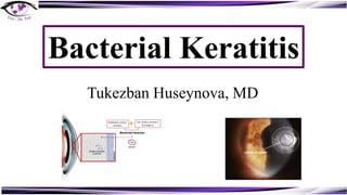 Bacterial Keratitis
Tukezban Huseynova, MD
 