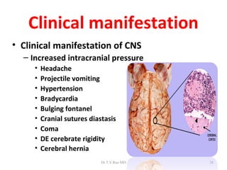 Clinical manifestation
• Clinical manifestation of CNS
  – Increased intracranial pressure
     •   Headache
     •   Projectile vomiting
     •   Hypertension
     •   Bradycardia
     •   Bulging fontanel
     •   Cranial sutures diastasis
     •   Coma
     •   DE cerebrate rigidity
     •   Cerebral hernia
                             Dr.T.V.Rao MD   28
 
