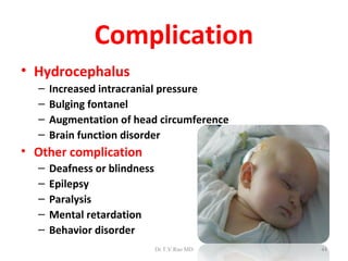 Complication
• Hydrocephalus
  –   Increased intracranial pressure
  –   Bulging fontanel
  –   Augmentation of head circumference
  –   Brain function disorder
• Other complication
  –   Deafness or blindness
  –   Epilepsy
  –   Paralysis
  –   Mental retardation
  –   Behavior disorder
                              Dr.T.V.Rao MD   44
 