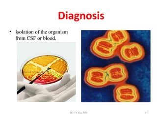 Diagnosis
• Isolation of the organism
  from CSF or blood.




                              Dr.T.V.Rao MD   47
 
