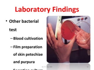 Laboratory Findings
• Other bacterial
 test
  – Blood cultivation

  – Film preparation
   of skin petechiae
   and purpura
                    Dr.T.V.Rao MD   52
 