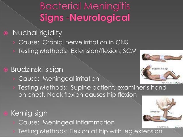 Image result for meningococcal meningitis P/E