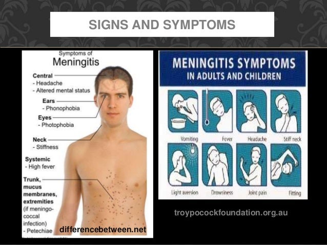 Bacterial meningitis