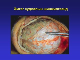 Эмгэг судлалын шинжилгээнд

 