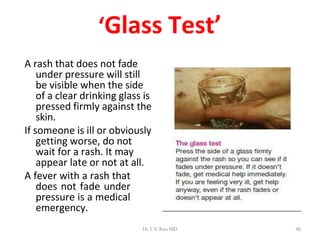 Rash Test bacterialmeningitis kdedekdedkekdehdeked | PPT