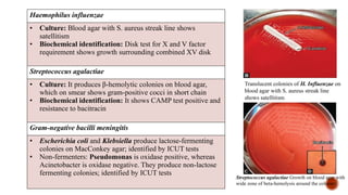BACTERIAL MENINGITIS SEMINAR FOR MD MICRIOBIOLOGY.pptx