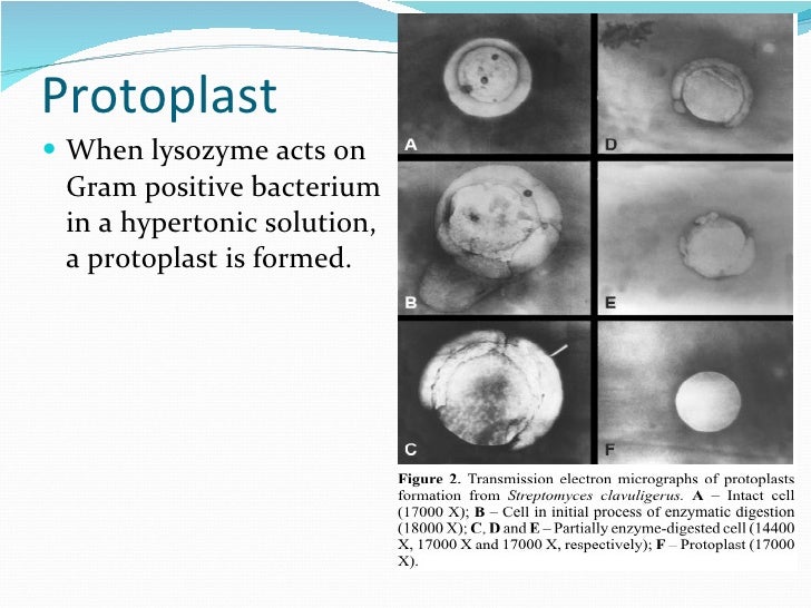 Bacterial morphology