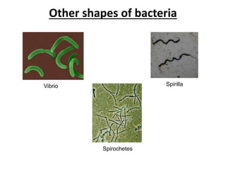 Other shapes of bacteria
Vibrio Spirilla
Spirochetes
 