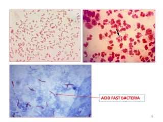 ACID FAST BACTERIA
7/1/2015 28Dr.Tarek/KUIN
 