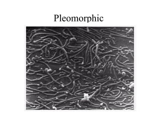 Pleomorphic
 