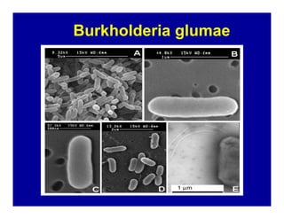 Bacterial panicle blight