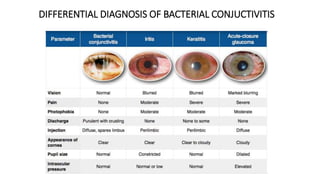 DIFFERENTIAL DIAGNOSIS OF BACTERIAL CONJUCTIVITIS
 