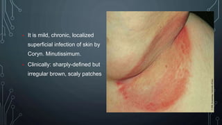 Bacterial skin infection- dermatology | PPTX