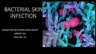BACTERIAL SKIN
INFECTION
SUBMITTED BY-RUPAM CHATURVEDI
GROUP –E1
ROLL NO -14
 