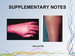 Soap Note Cellulitis Bacterial skin infections from osun state University Nigeria | PPT