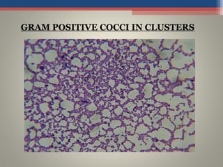 GRAM POSITIVE COCCI IN CLUSTERS
 