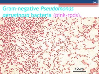 Gram-negative Pseudomonas
aeruginosa bacteria (pink-rods).
30
 