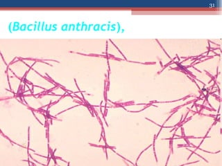 (Bacillus anthracis),
31
 