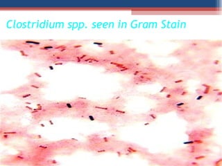 Clostridium spp. seen in Gram Stain
 