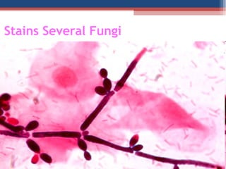 Stains Several Fungi
 